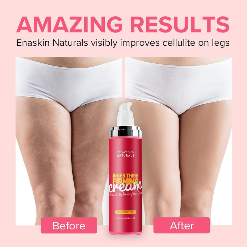 Cellulite Cream for Inner Thighs - Skin Tightening Cream for Legs & Stomach with Collagen Peptides, Hyaluronic Acid & Honey - Lifting Firming Body Lotion for Women, 100 ML
