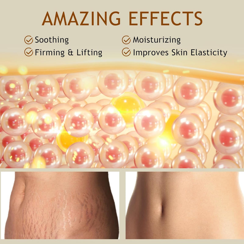 B Flat Belly Firming Cream, Cellulite Belly Cream, Skin Tightening Creams for Cellulite for Stomach Mark & Thighs & Butt, Moisturizing Lifting Body Lotion for Women and Men - 3.38 Fl OzF
